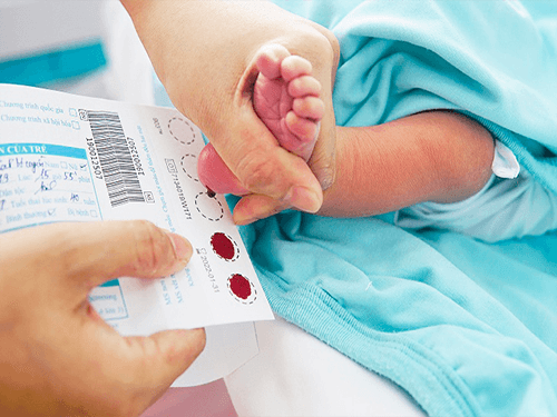Lấy máu gót chân trẻ sơ sinh: Phát hiện sớm dị tật bẩm sinh